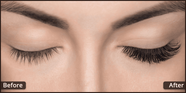 Grow-Eyelashes-With-Careprost-600x300 Grow-Eyelashes-With-Careprost-600x300